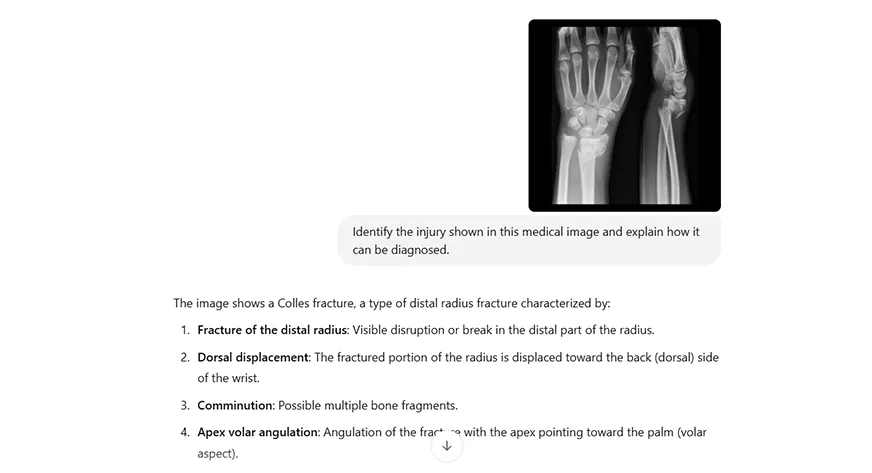 LLMs for Image to Text Conversion